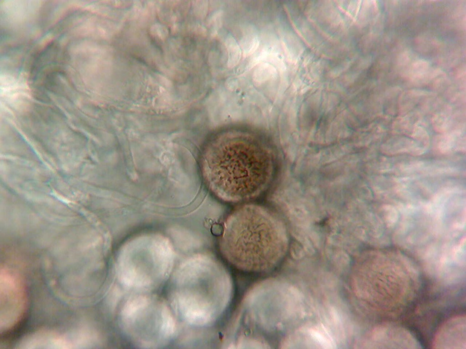 Elaphomyces granulatus