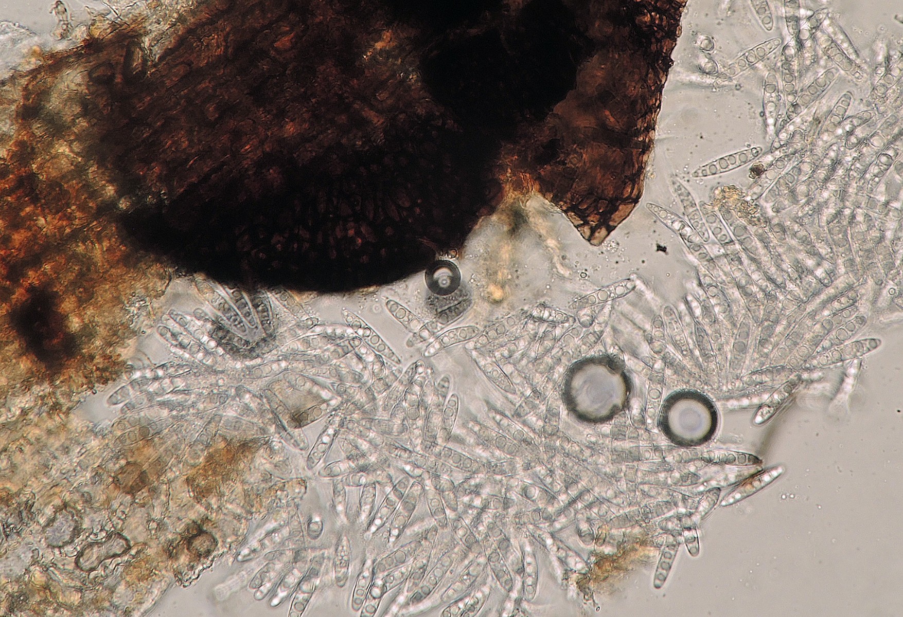 Stagonospora subseriata