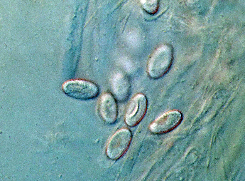 Sowerbyella brevispora