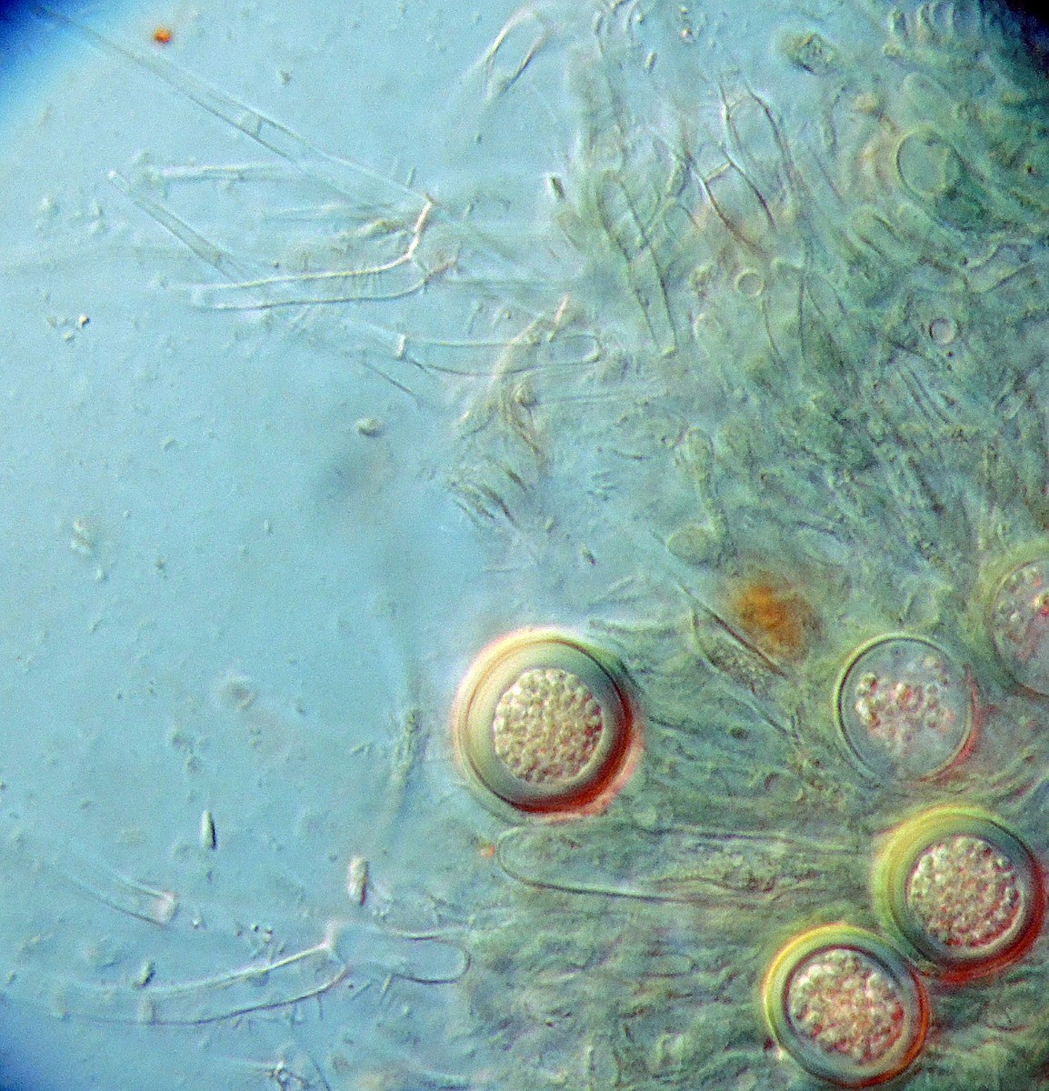 Hypomyces leotiicola