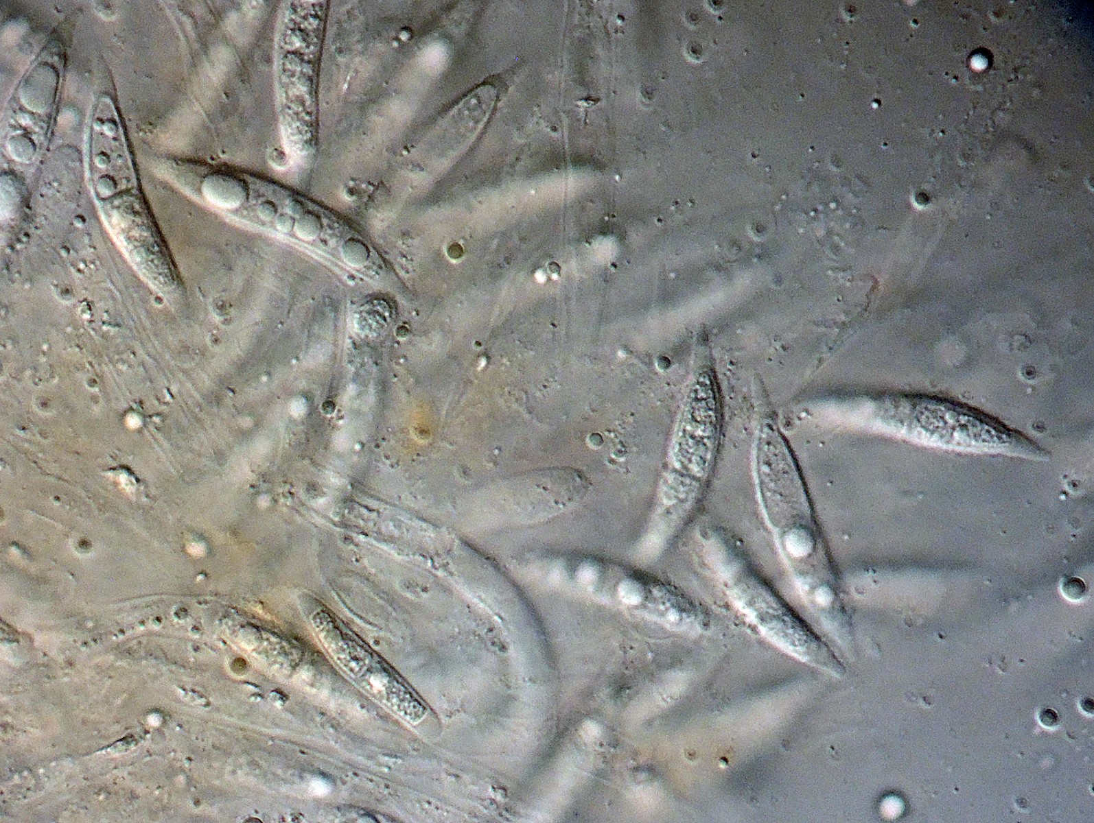 Hypomyces ochraceus