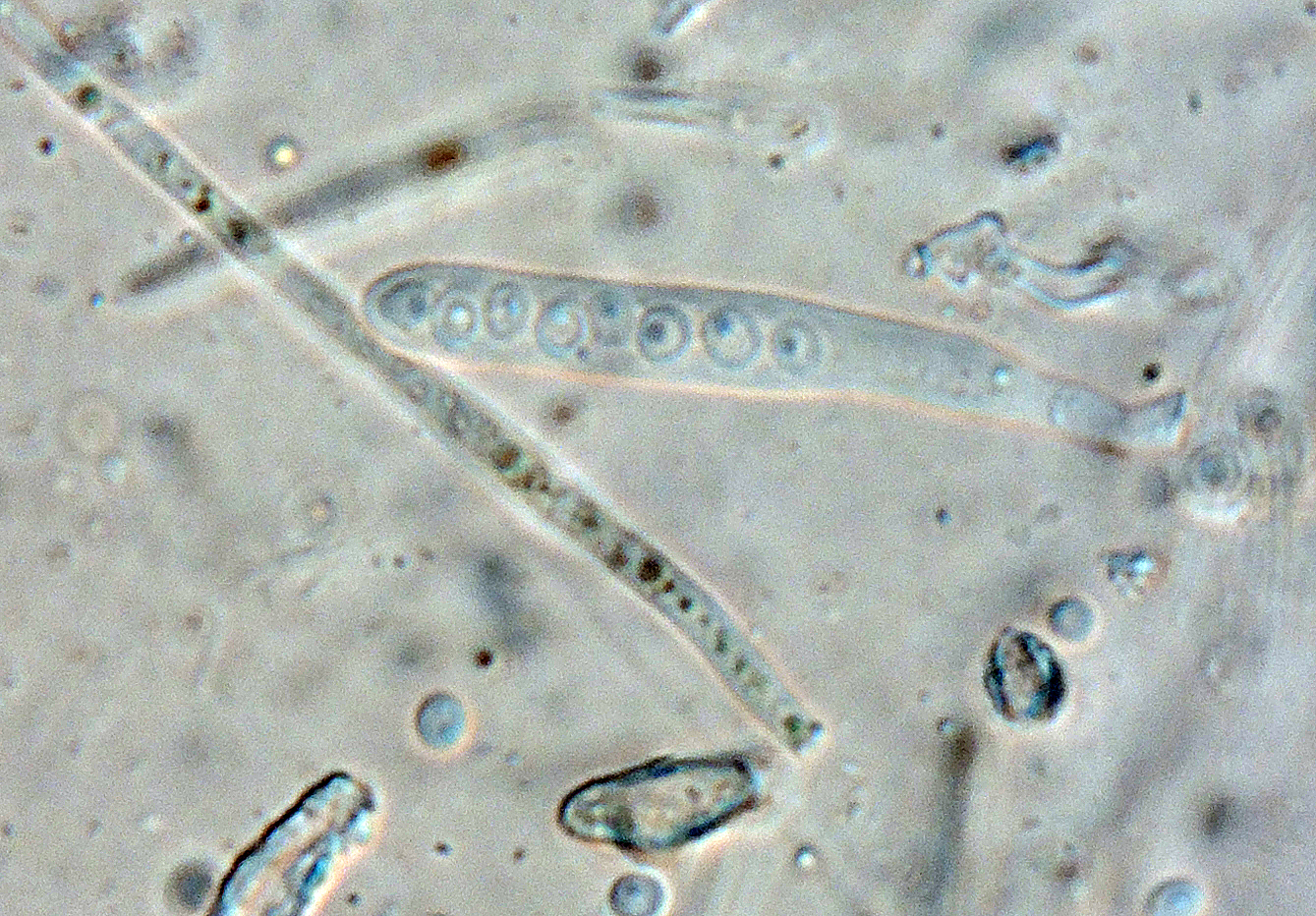 Lachnellula calycina