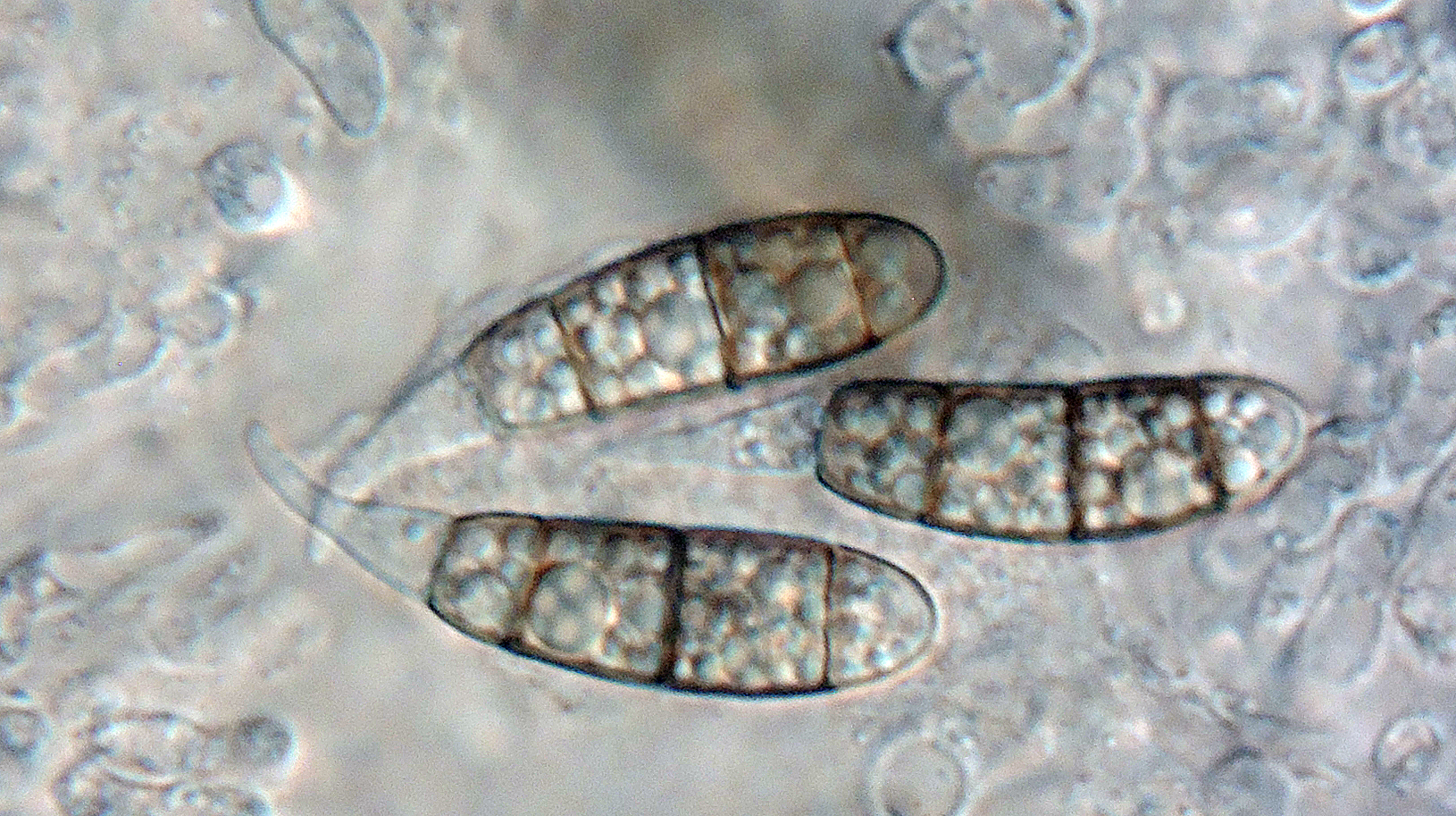 Rebentischia unicaudata