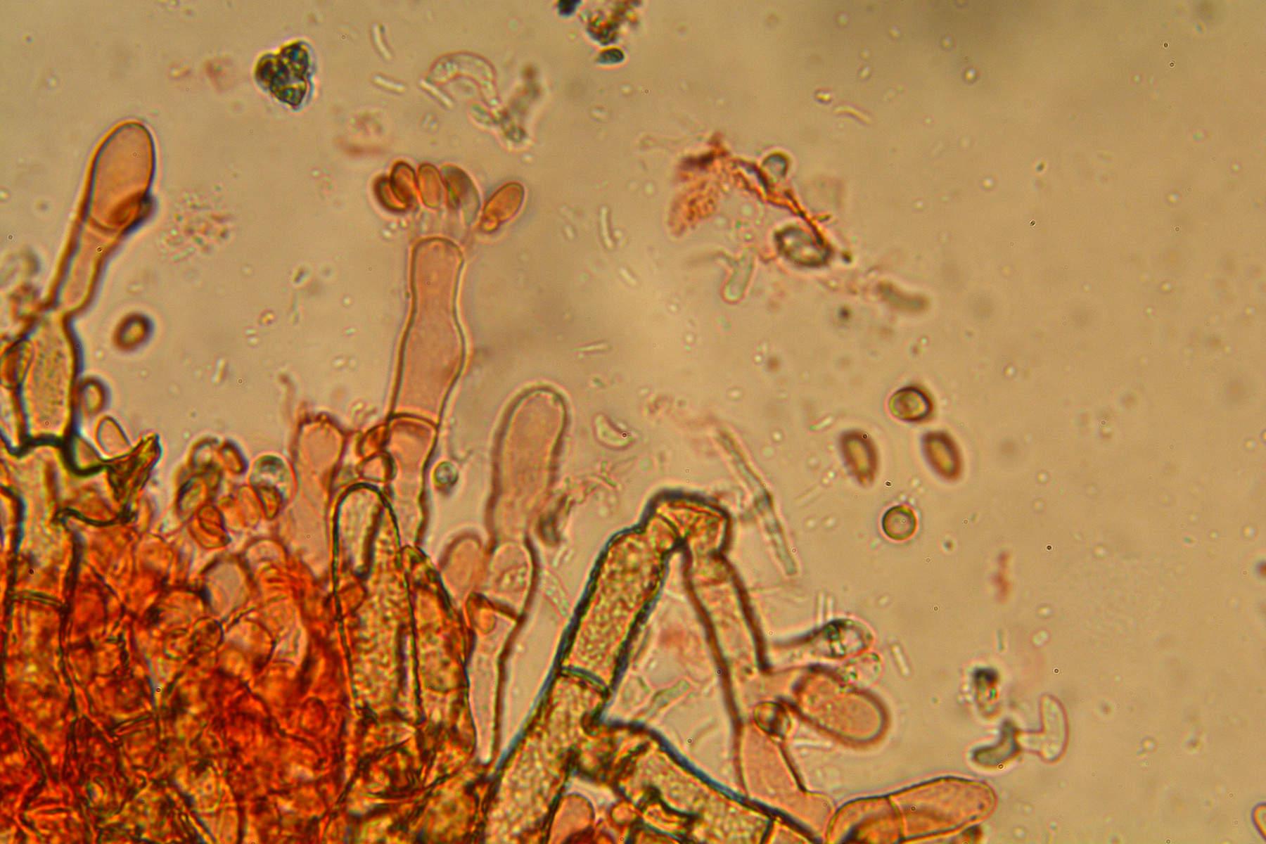 Botryobasidium pruinatum