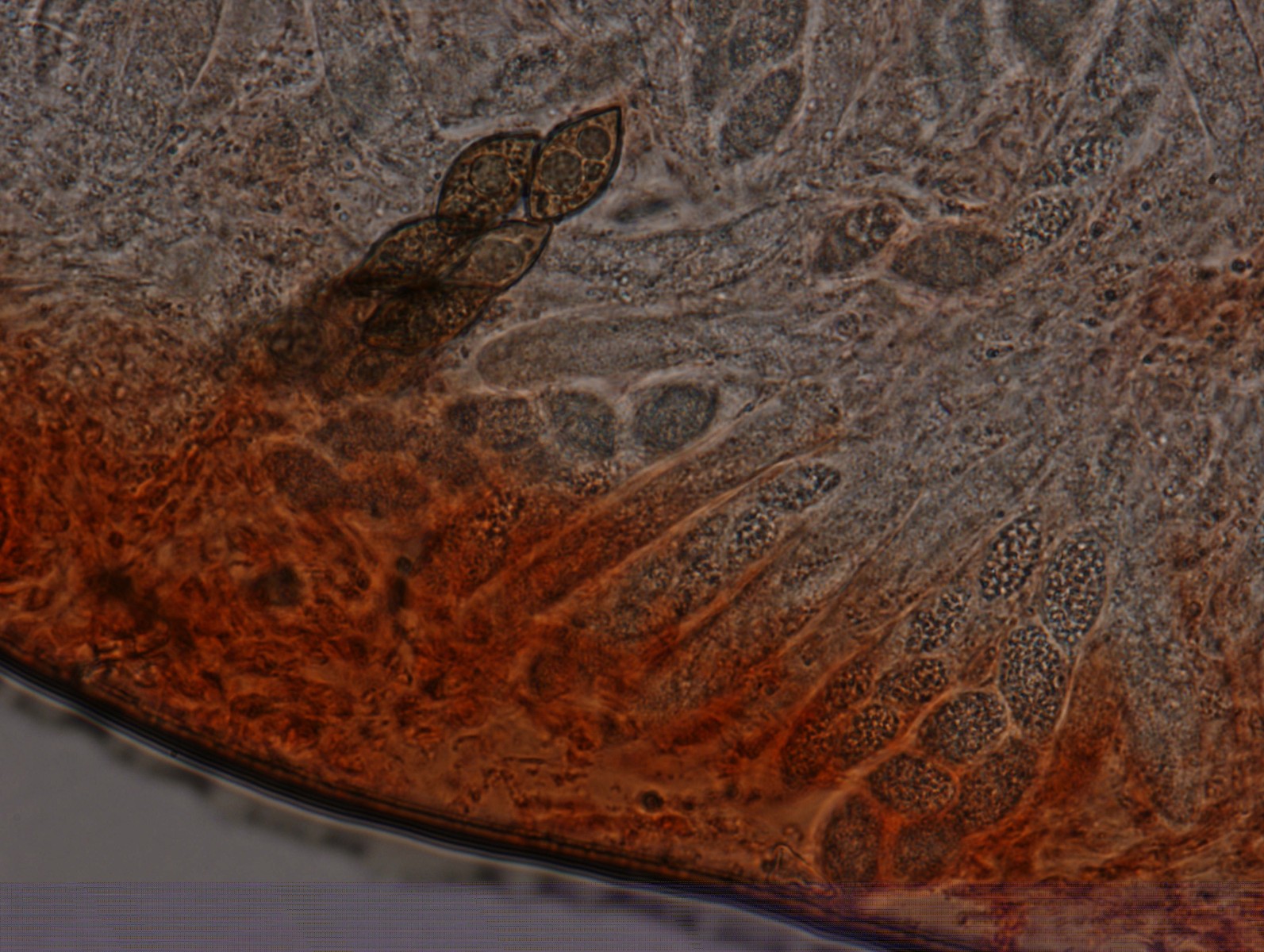 Roselliniella cladoniae