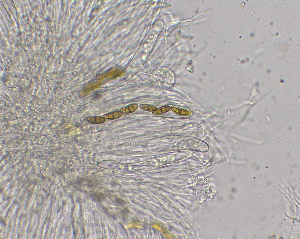 Paraconiothyrium fuckelii (Sacc.) Verkley & Gruyter