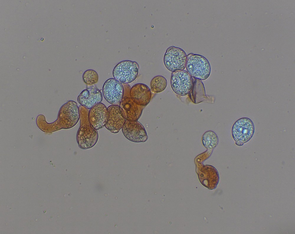 Neozygites fresenii