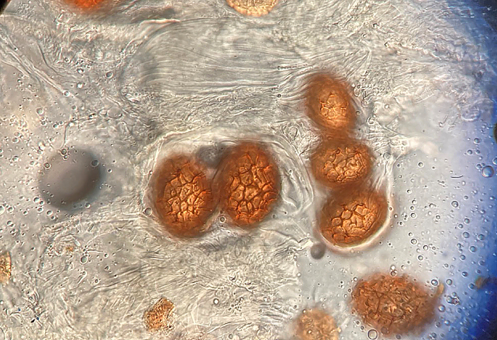 Tuber macrosporum